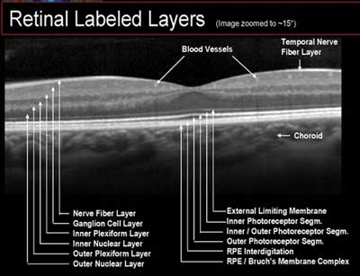 OCT Retina